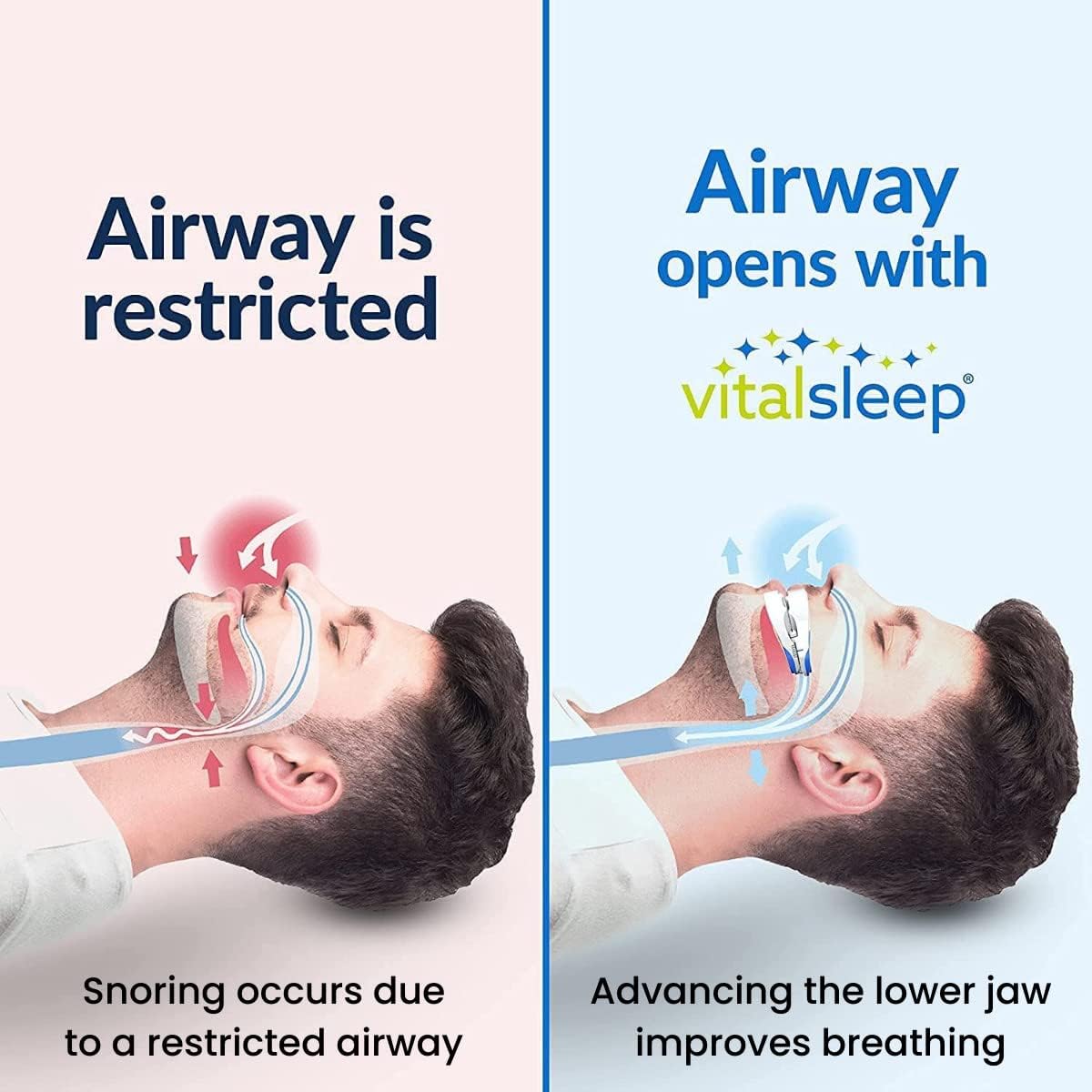 VitalSleep Anti-Snoring Mouthpiece + Sleep Mask, Custom Adjustable Jaw Positioning, USA Made & FDA Cleared Snoring Solution, BPA-Free, Comfortable Fit - Image 3